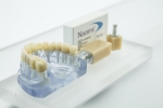 RĂNG SỨ NACERA LÀ GÌ? ƯU NHƯỢC ĐIỂM & GIÁ CẢ