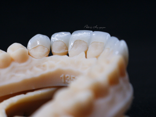 VENEER