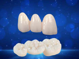 RĂNG SỨ ZIRCONIA