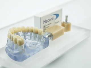 RĂNG SỨ NACERA LÀ GÌ? ƯU NHƯỢC ĐIỂM & GIÁ CẢ